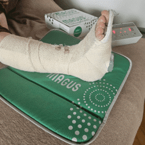 Depilacija Sano center